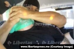 Fotografija policijske torture nad uhapšenima, koju je objavio Libertas sa SKY aplikacije