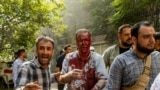 Ин мард дар ҳамлаи Исроил ба Эрон захмӣ шудааст